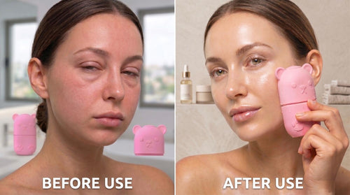 GlowBear™ Ice Face Roller – Pore Tightening & De-Puff Skin Tool